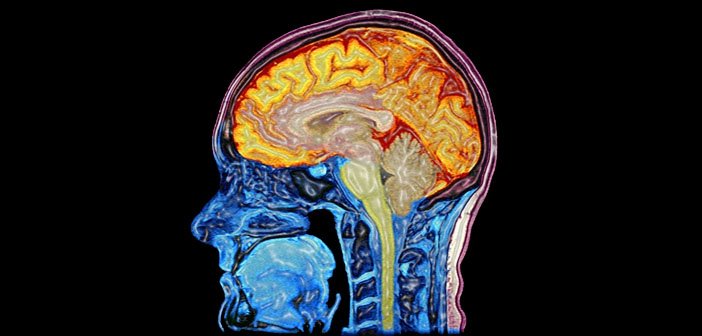 MRI scan mozgu Autor: Mark Lythgoe & Chloe Hutton. Wellcome Images, https://wellcomecollection.org/works